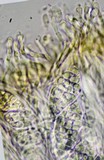 Leptogium palmatum image