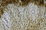 Arthonia phaeobaea image