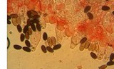 Psathyrella bipellis image