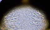 Anisomeridium biforme image