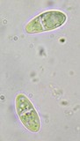 Anisomeridium biforme image