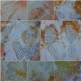 Phlyctis agelaea image