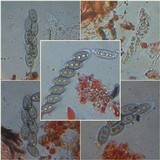 Pyrenula chlorospila image