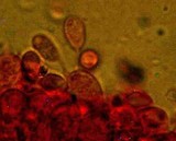 Mycena aciculata image