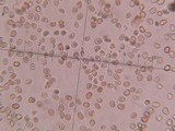 Fistulina guzmanii image