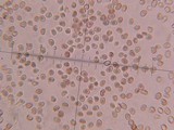 Fistulina guzmanii image