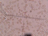 Fistulina guzmanii image