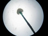 Dendrostilbella smaragdina image
