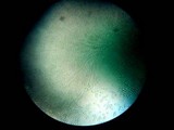 Dendrostilbella smaragdina image
