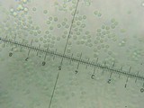 Dendrostilbella smaragdina image