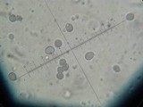 Amanita brunneolocularis image