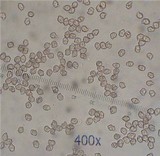 Entoloma vernum image
