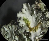 Heterodermia pseudospeciosa image