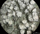 Pertusaria amara f. amara image