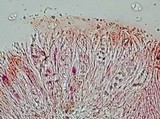 Caloplaca litoricola image