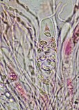 Caloplaca litoricola image