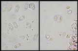 Caloplaca litoricola image