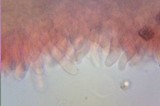 Rhodocollybia maculata image