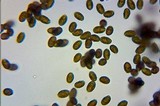 Melanoleuca cognata image