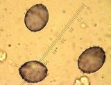 Aleurodiscus grantii image