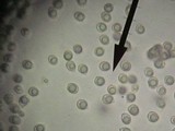 Amanita sect. Vaginatae image