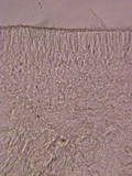 Hyalorbilia inflatula image