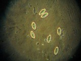 Galiella rufa image