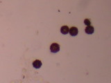 Mycenastrum corium image