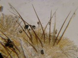 Cheilymenia fimicola image