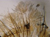 Cheilymenia fimicola image