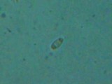 Caloplaca ulcerosa image