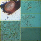 Ochrolechia szatalaensis image