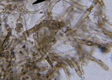 Tylopilus felleus image