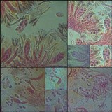 Caloplaca cerina image