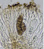 Diplotomma chlorophaeum image