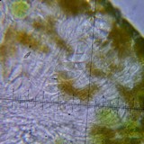 Candelariella antennaria image