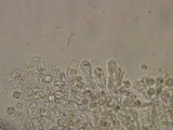 Gloeohypochnicium analogum image