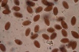 Melanogaster tuberiformis image