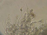 Basidioradulum crustosum image