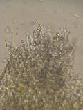 Basidioradulum crustosum image
