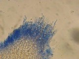 Basidioradulum crustosum image