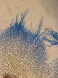 Hyphodontia subalutacea image