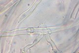 Loweomyces fractipes image