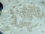 Tremella fuciformis image