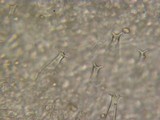 Pluteus petasatus image