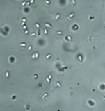 Poronia pileiformis image