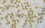 Inocybe lilacina image