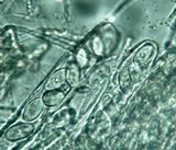 Ascobolus scatigenus image