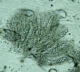 Ascobolus scatigenus image