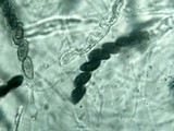 Hypoxylon haematostroma image